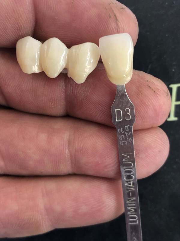 Yucera Professional Teeth Material 98mm Zirconia Dental Blank 3D Ceramic Teeth Zirconium Block