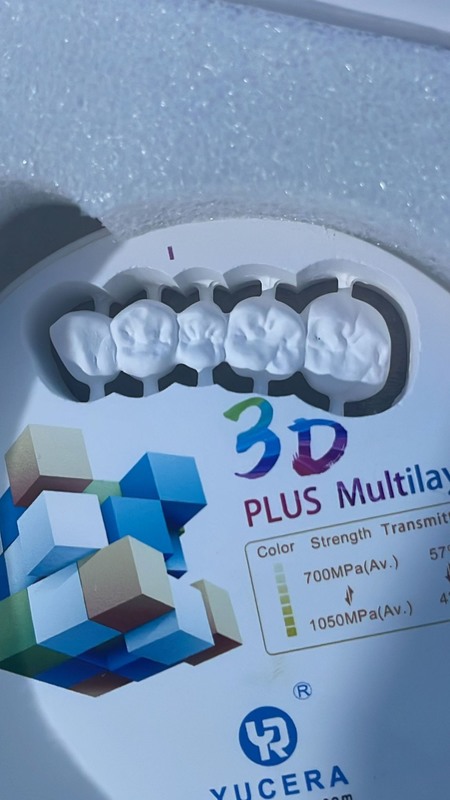 Yucera 3D Pro Multilayers Zircon Blocks for Zircon Zahn Dental Cad Cam Milling Machine