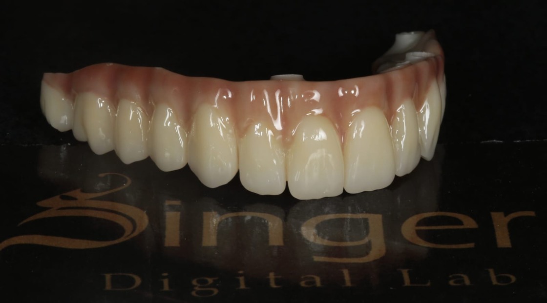 Yucera 8 Layeries Dental Zirconia Block 4D Pro Multilayer for CADCAM Lab Materials Open System 43%-57% Strength 700-1200Mpa