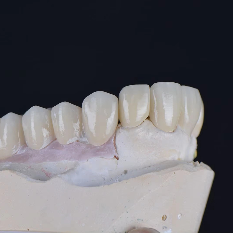 Yucera 4D Plus Pre-shaded Multilayer Zirconia Blocks Dental Implant Orthodontic Materials Multilayer Zirconia 8 Layers