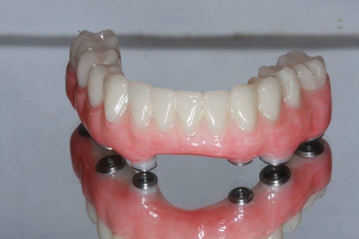 युसेरा कैड कैम मल्टी पीएमएमए डिस्क डेंटल मटेरियल पीएमएमए ब्लॉक्स डेंटल ज़िरकोनिया डिस्क फ्लेक्सिबल पीएमएमए रेज़िन ब्लॉक्स