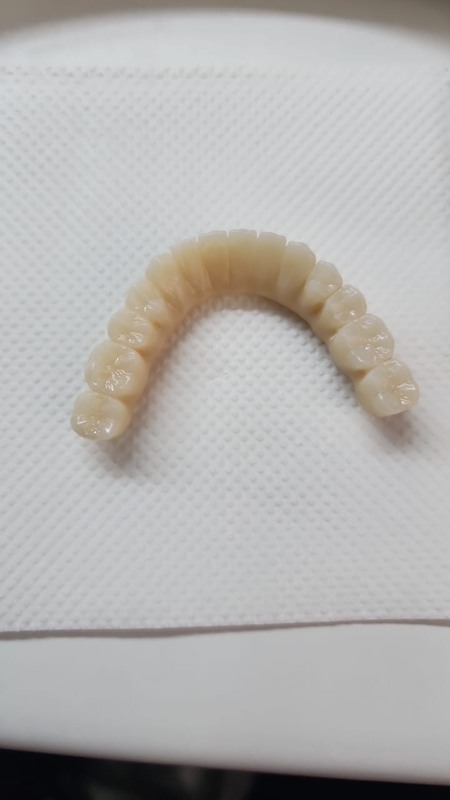 Yucera 4D Pro High - Precision 3D Multilayer Dental Zirconia Block Stable and Reliable Creating Ideal Restoration Results