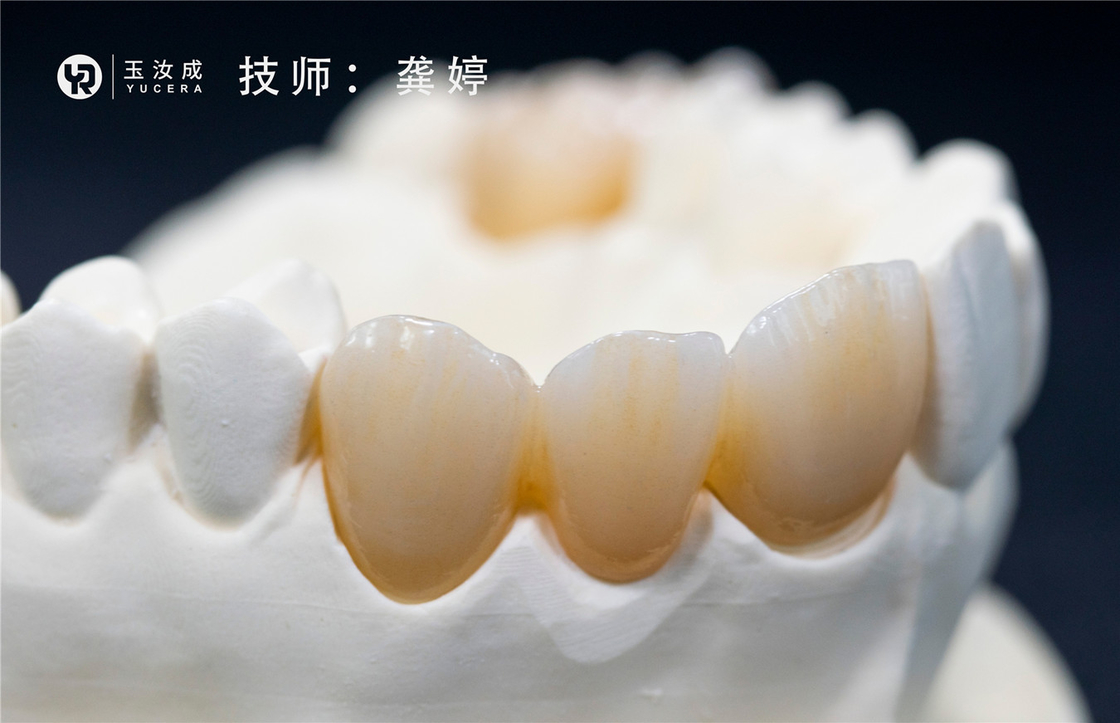 युसेरा 3डी प्लस मल्टीलायर जिरकोनिया ब्लॉक 98x16mm ओपन सिस्टम फॉर पोस्टीरियर क्राउन